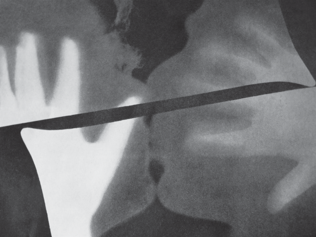 Fotograma em preto e branco de Man Ray (Rayograph, 1922): sobre fundo escuro e granulado, silhuetas claras e difusas de duas mãos abertas, à esquerda e à direita, e de dois perfis de rosto em cinza que se aproximam no centro; uma faixa escura atravessa a imagem em diagonal. Os contornos são difusos e as formas se sobrepõem em tons de cinza.