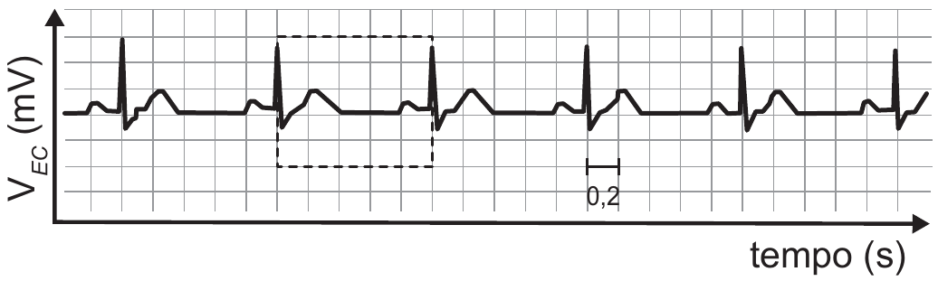 Eletrocardiograma sobre papel quadriculado: eixo vertical V com índice EC, em milivolts; eixo horizontal, tempo em segundos. A curva mostra seis batimentos iguais, cada um com um pico alto e estreito seguido de uma onda baixa e larga. Um retângulo tracejado marca um batimento inteiro, do segundo ao terceiro pico, e ocupa cinco divisões da malha. Uma barra de escala junto ao eixo indica que cada divisão vale 0,2 s.