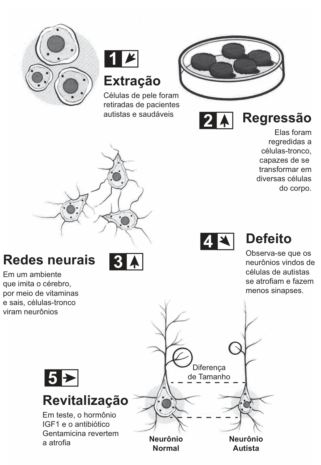 Infográfico em cinco etapas numeradas, com desenhos e textos. 1, Extração: "Células de pele foram retiradas de pacientes autistas e saudáveis" (desenho de três células). 2, Regressão: "Elas foram regredidas a células-tronco, capazes de se transformar em diversas células do corpo." (desenho de uma placa de cultura com células). 3, Redes neurais: "Em um ambiente que imita o cérebro, por meio de vitaminas e sais, células-tronco viram neurônios" (desenho de neurônios ramificados). 4, Defeito: "Observa-se que os neurônios vindos de células de autistas se atrofiam e fazem menos sinapses." 5, Revitalização: "Em teste, o hormônio IGF1 e o antibiótico Gentamicina revertem a atrofia". Embaixo, dois neurônios lado a lado rotulados "Neurônio Normal" e "Neurônio Autista", com a indicação "Diferença de Tamanho" entre eles (o neurônio autista é menor).