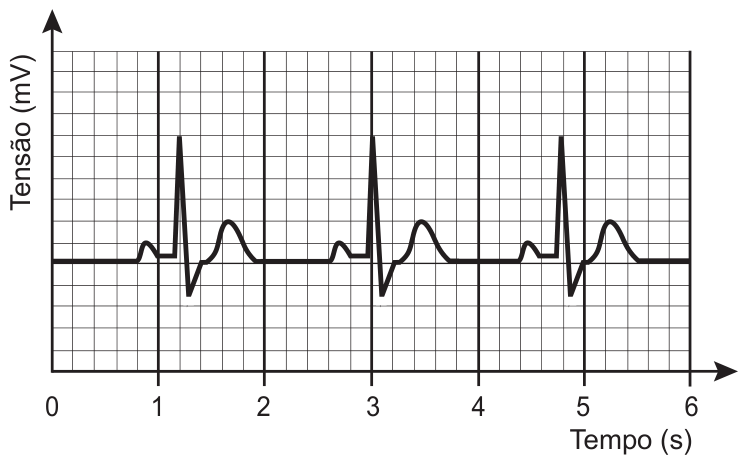 Gráfico de tensão (mV) em função do tempo (s), com grade quadriculada e eixo horizontal de 0 a 6 s. A curva mostra três batimentos idênticos (pequena onda, pico alto estreito seguido de vale, e onda arredondada), com os picos em aproximadamente 1,2 s, 3,0 s e 4,8 s.