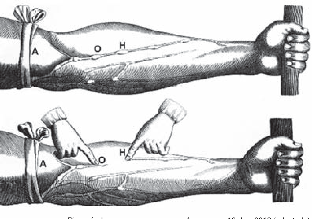Duas gravuras antigas de um antebraço com torniquete marcado A próximo ao cotovelo e veias inchadas; pontos marcados O e H ao longo de uma veia. Na gravura de baixo, dois dedos pressionam a veia nos pontos O e H, e o trecho entre eles aparece vazio.