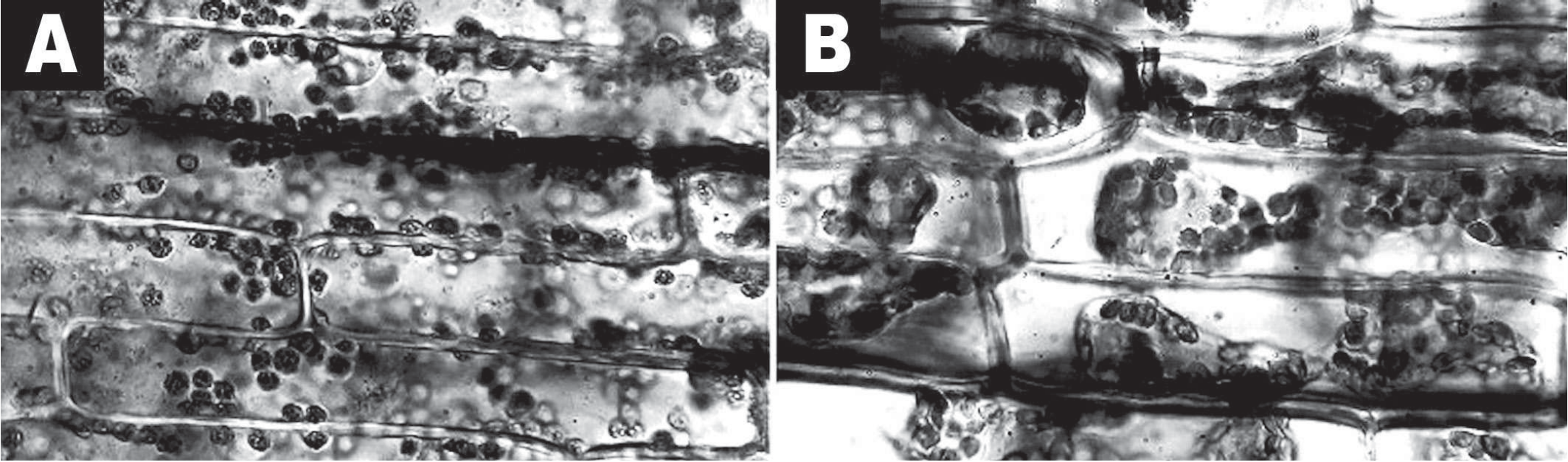 Duas micrografias de tecido vegetal. Figura A: células alongadas com cloroplastos (pontos escuros) espalhados por todo o interior, junto às paredes. Figura B: células em que o conteúdo escuro está retraído e aglomerado no centro, com espaços claros entre ele e as paredes celulares.