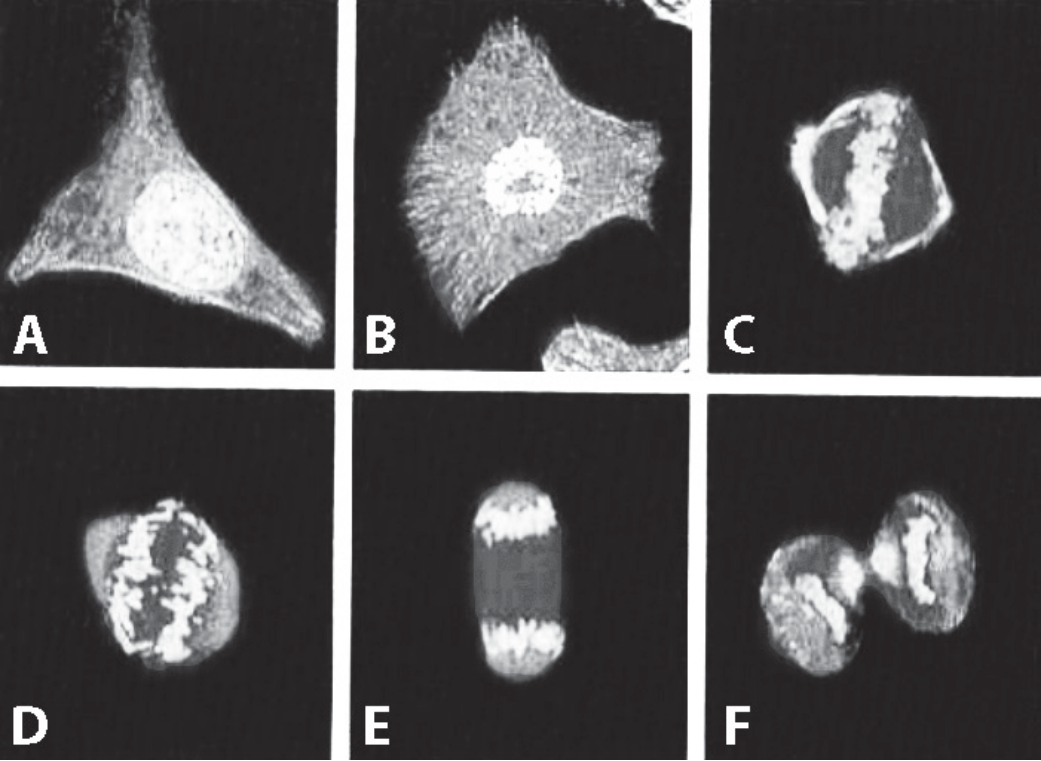 Painel com seis micrografias em preto e branco de uma célula, rotuladas de A a F. A: célula triangular grande com um núcleo redondo e claro. B: célula estrelada com núcleo redondo e claro e filamentos radiais. C: célula arredondada com o material claro condensado numa faixa irregular. D: célula arredondada com o material claro concentrado numa placa no centro. E: célula alongada com duas massas claras separadas, uma em cada extremidade. F: duas células arredondadas em contato, cada uma com sua massa clara.
