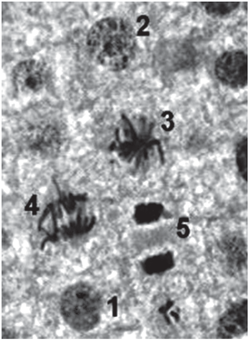 Fotomicrografia em preto e branco de células do tecido da raiz de cebola, com cinco células numeradas. Na célula 1 (embaixo, à esquerda) e na célula 2 (no alto), o núcleo aparece como uma mancha arredondada, escura e granulosa. Na célula 3 (centro), o material genético aparece como filamentos escuros e grossos reunidos numa faixa no meio da célula. Na célula 4 (à esquerda) os filamentos escuros estão espalhados, dispersos pela célula. Na célula 5 (à direita), o material escuro aparece separado em duas massas compactas, uma em cada extremidade da célula.